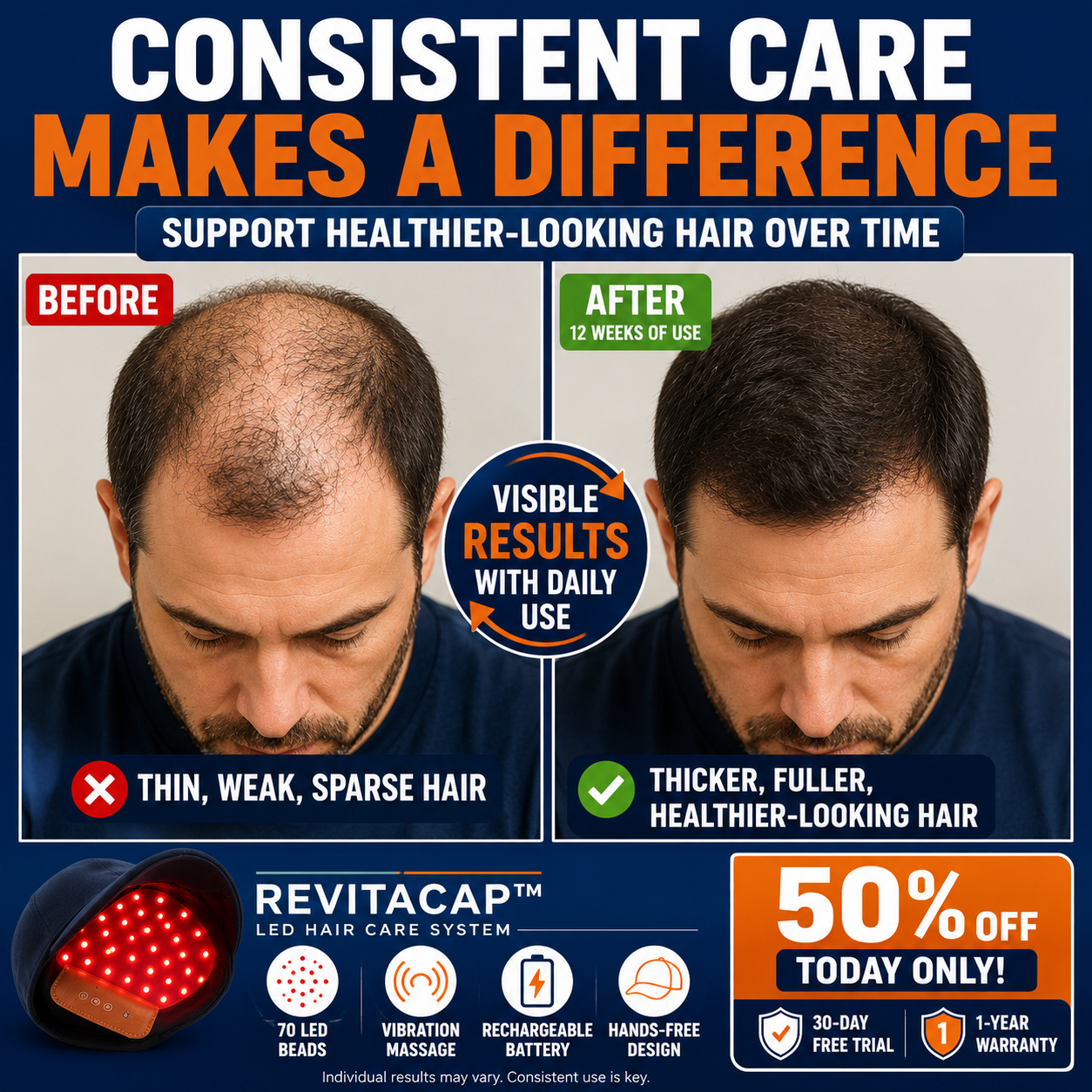 RevitaCap™ LED Hair Care System