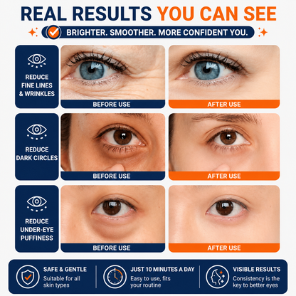 EyeLift™ Pro - 10-Minute Eye Rejuvenation System